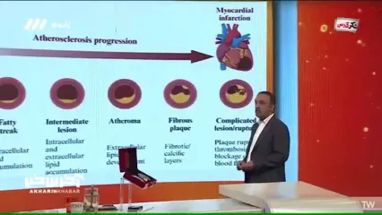 علت اصلی سکته قلبی چیست؟ پاسخ این سوال را در این ویدیو ببینید