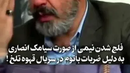 ماجرای فلج شدن نیمی از صورت سیامک انصاری برای بازی در سریال مهران مدیری