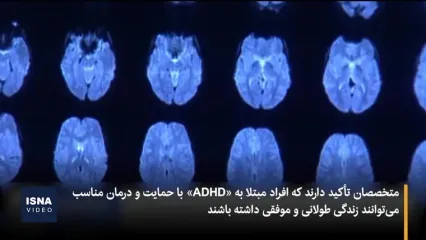 آیا ابتلا به "ADHD" در طول عمر افراد نقش دارد؟