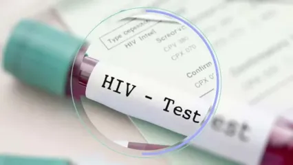 hiv ab چیست؟