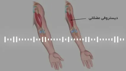 دیستروفی عضلانی چیست ؟