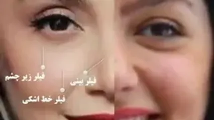 آنالیز زیبایی صورت نازنین بیاتی مریم سریال تاسیان / خانم بازیگر چی بوده چی شده!