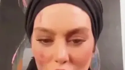 فیلم شاخ دربیار / سحر قریشی : من فقط یکبار ازدواج کردم ! سحر قریشی چی به روز صورت زیبا و صافش آورده ! / حیف اون چهره ای که حالا اینجوری خرابش کرده!؟