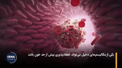 چرا نباید با چراغ روشن بخوابیم؟