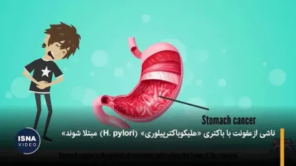 باکتری خطرناک معده: علت اصلی 12 میلیون سرطان