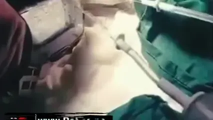 ببینید؛ خارج کردن نیزه فلزی از دهان کودک ۱۱ ساله در ایرانشهر