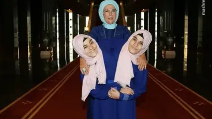 خواسته عجیب دو خواهر دوقلوی به‌هم‌چسبیده