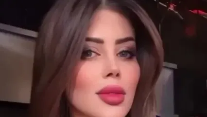 خانم خواننده مشهور بعد از کنسرت نابینا شد / شوک بزرگ برای خوانندگان جهان