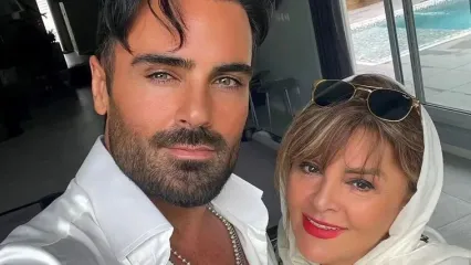 نگاهی به تغییر چهره و صدای سهراب پاکزاد؛ خواننده پرطرفدار/ عملهای زیبایی چیکار کرده با صورت ایشون!