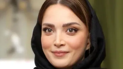 ویدئو زیرخاکی از بهنوش طباطبایی قبل از عمل زیبایی