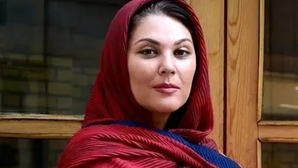 تغییر چهره لاله اسکندری بعد از عمل زیبایی