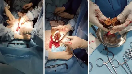 هشدار جدی برای شب یلدا / این میوه را همراه انار نخورید