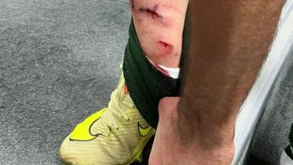 این سه صحنه داوری صدای پرسپولیس و حریفش را درآورد