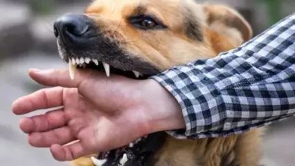 فیلم از لحظه مجروح شدن یک کودک بلوچ در پی حمله یک سگ ولگرد در زاهدان