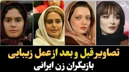 تغییر چهره باورنکردنی و هوش‌پران بازیگران زن پس از عملهای زیبایی؛ سحر دولتشاهی، الناز حبیبی، نیوشا ضیغمی و...