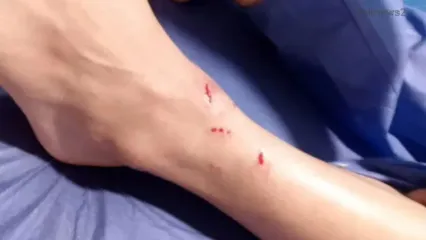 فیلم لحظه هجوم گرگ در محوطه دانشگاه زنجان / دانشجو زخمی شد