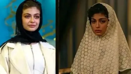 تغییر چهره ستایش دهقان بازیگر سریال شکارگاه در 17 سالگی با تزریق ژل / زود دست به کار شد