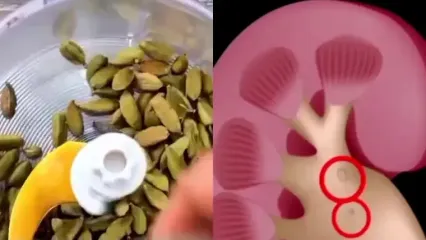شما هم سنگ کلیه دارین؟ از مصرف هل غافل نشین