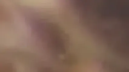 پروانه زنده از گوش مرد ۴۰ ساله خارج شد