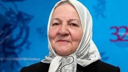 تغییر چهره چشمگیر بازیگر «وضعیت سفید» بعد از سال‌ها!