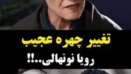 ماجرای تغییر چهره «رویا نونهالی» چیست؟
